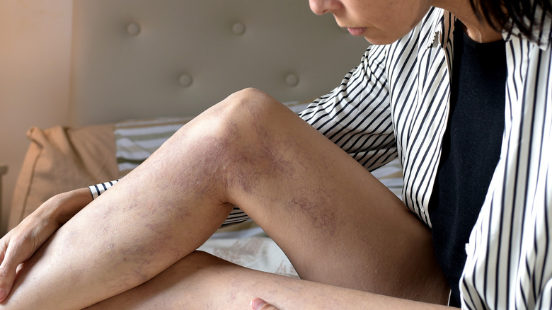 Woman looking at her legs