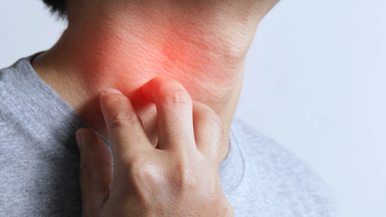 man touching neck with red mark