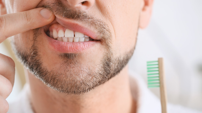 Man pointing at teeth