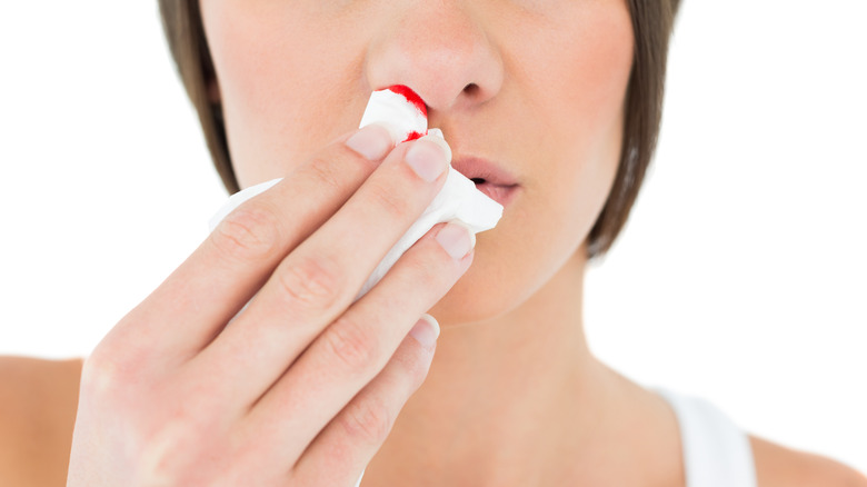 woman with bleeding nose on white background