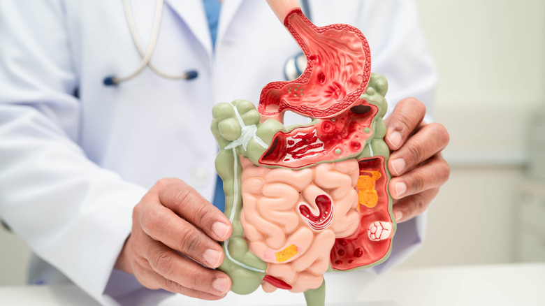 Doctor holding a model of the digestive system