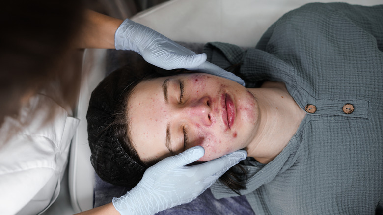 Teenager with acne at cosmetologist appointment