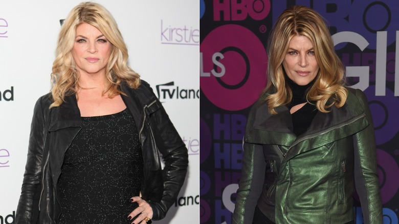 Side-by-side photos showing Kirstie Alley's weight loss