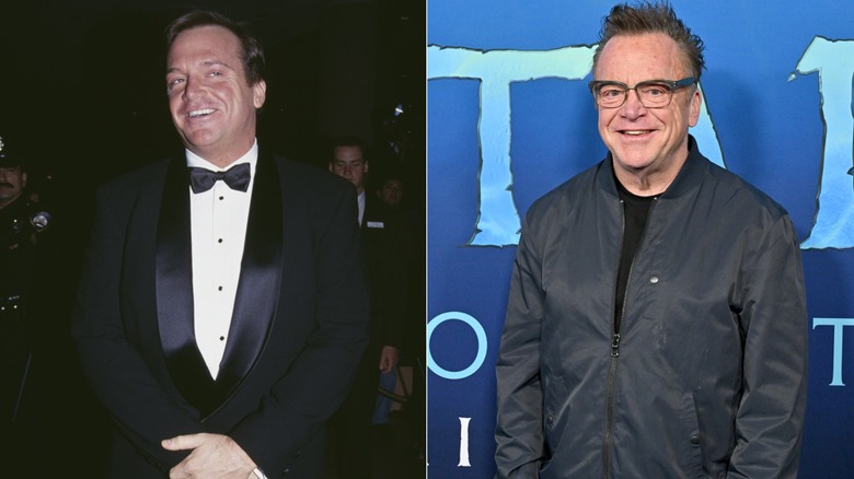 Side-by-side photos showing Tom Arnold's weight loss