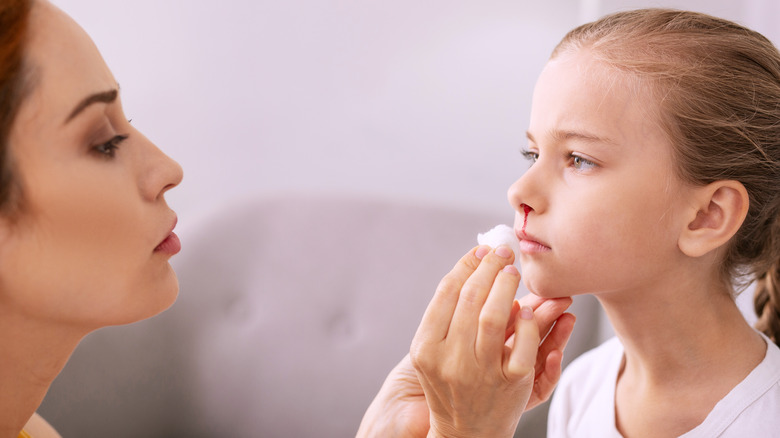 mother helping young girl stop a bloody nose