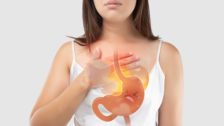 woman with diagram of stomach