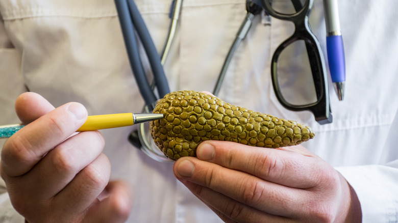 Doctor holding an anatomical model of the pancreas
