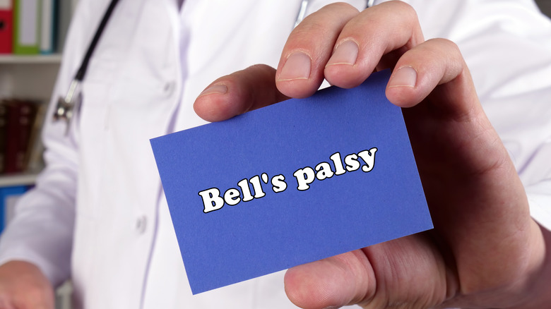 Doctor holding a blue card that says Bell's palsy