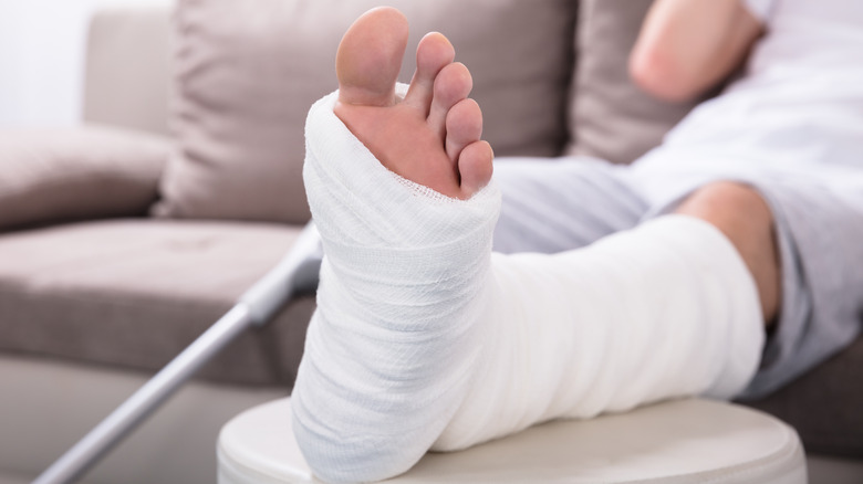 Man on couch with broken leg