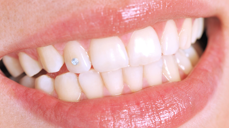 teeth with diamond tooth gem