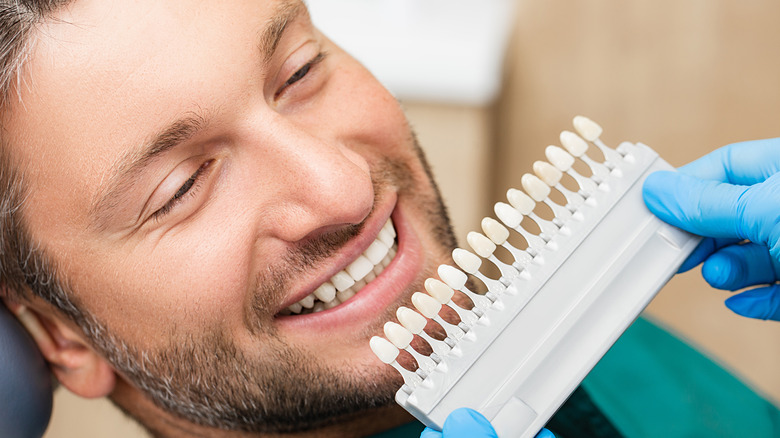 Dentist using palette tooth color sample to determine color of veneers