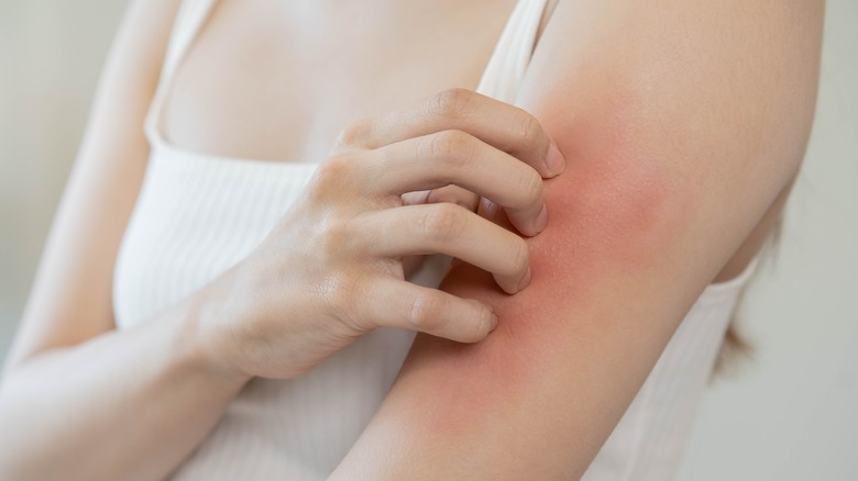 woman with itchy skin