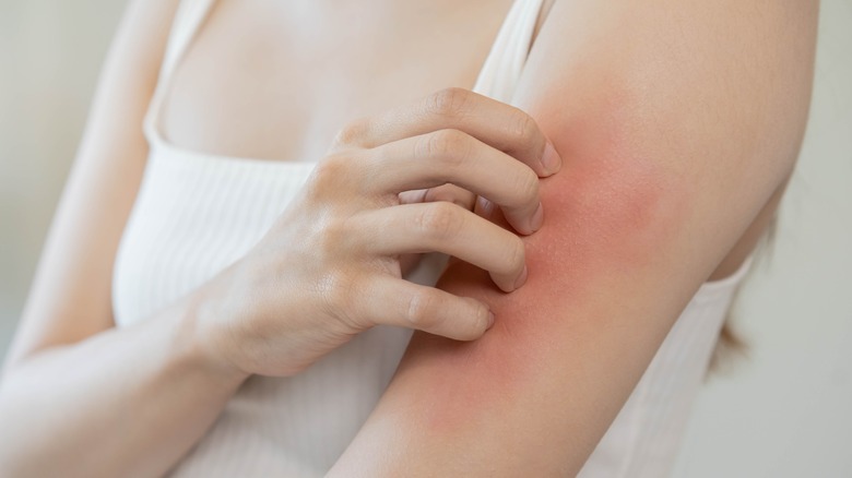 woman with itchy skin