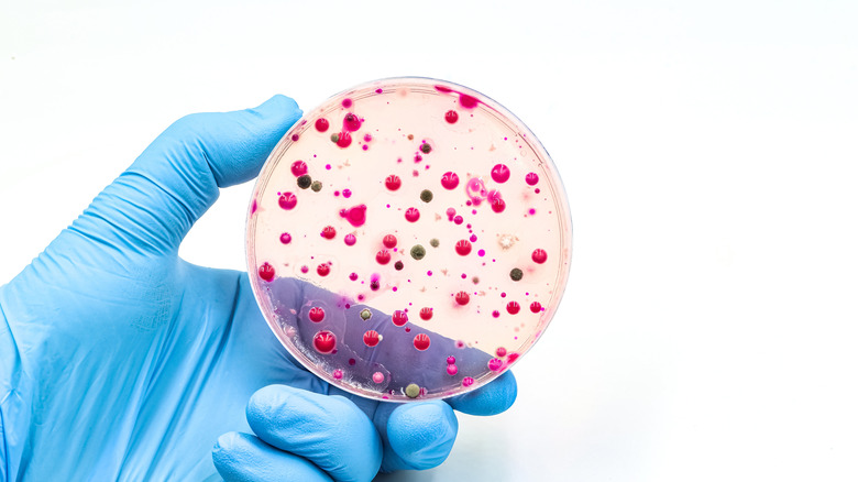 medical provider holding a lab vessel filled with bacteria