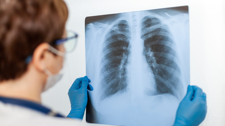 a doctor examines a chest x-ray