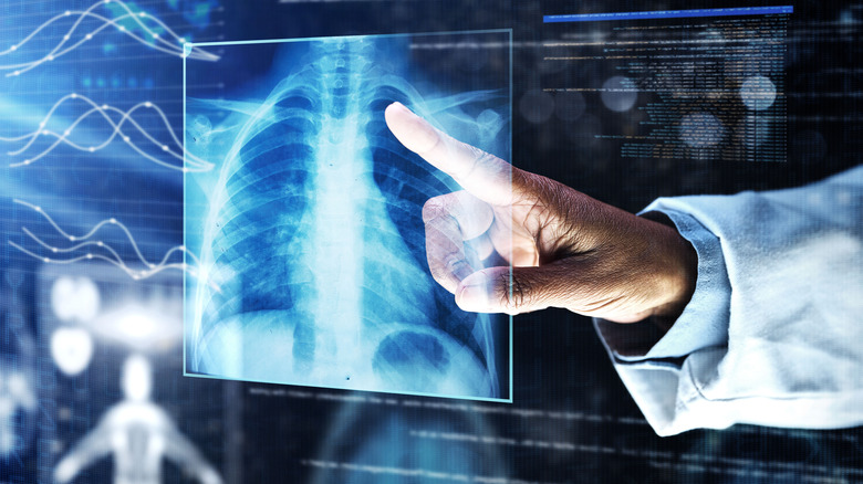 Physician pointing at chest x-ray