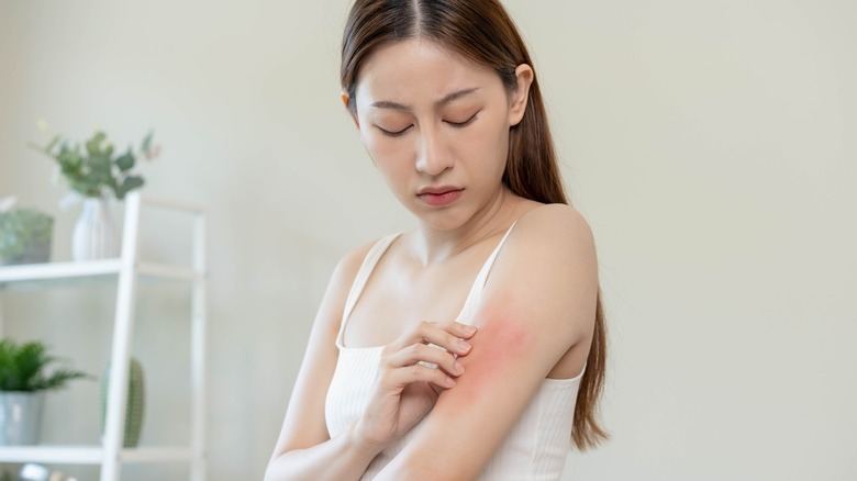 woman with eczema touching skin