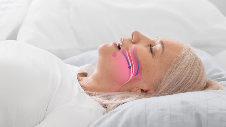 woman snoring with sleep apnea