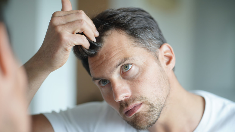 A man is worried about hair loss