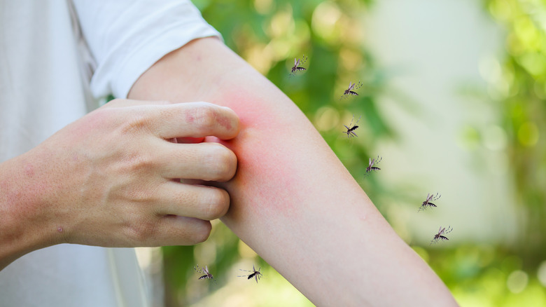 mosquitos biting arm