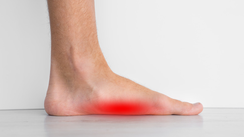 man in pain from flat feet