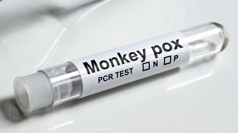 Monkeypox lab test vial