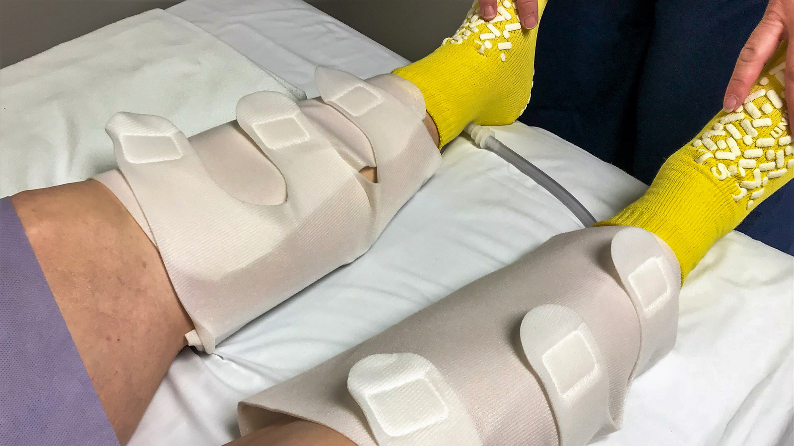 Can You Naturally Dissolve Blood Clots In Your Leg?