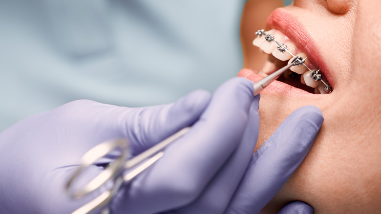 Someone gets their braces checked