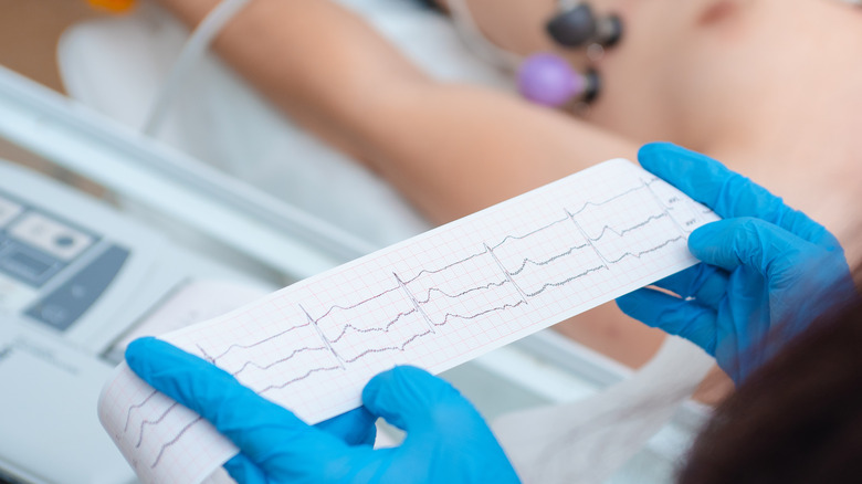 a heart cardiogram in the hands of physician