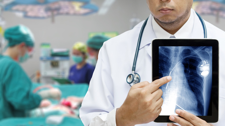 doctor pointing at tablet showing implanted pacemaker