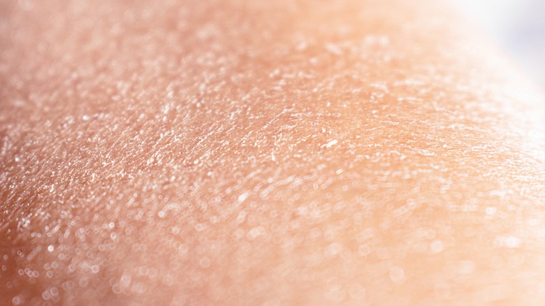 opadgående provokere religion 13 Causes Of Peeling Skin You Might Not Know