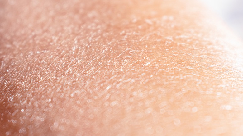 dry flaky skin close up