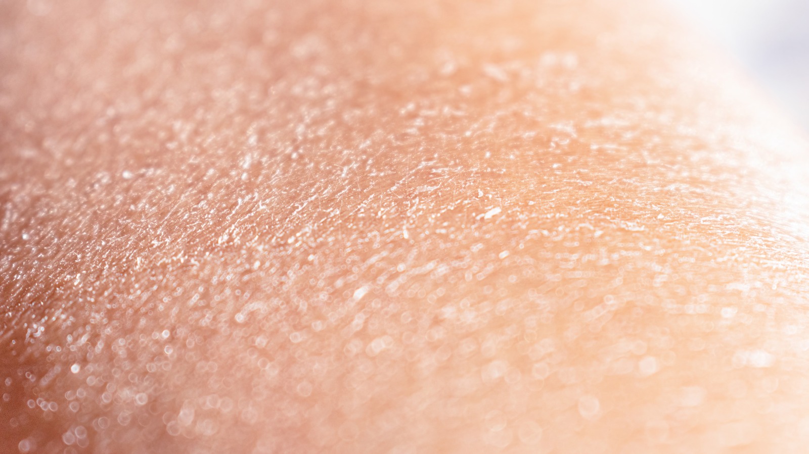 Causes Of Peeling Skin You Might Not Know