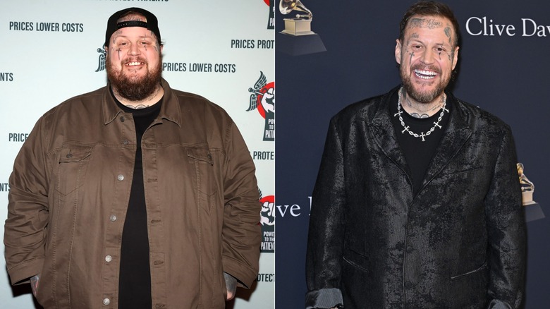 Split image of Jelly Roll when he was just starting to lose weight and after a 300-pound weight loss