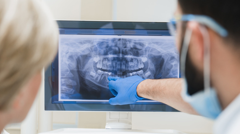 dental professionals examining xray of patient mouth