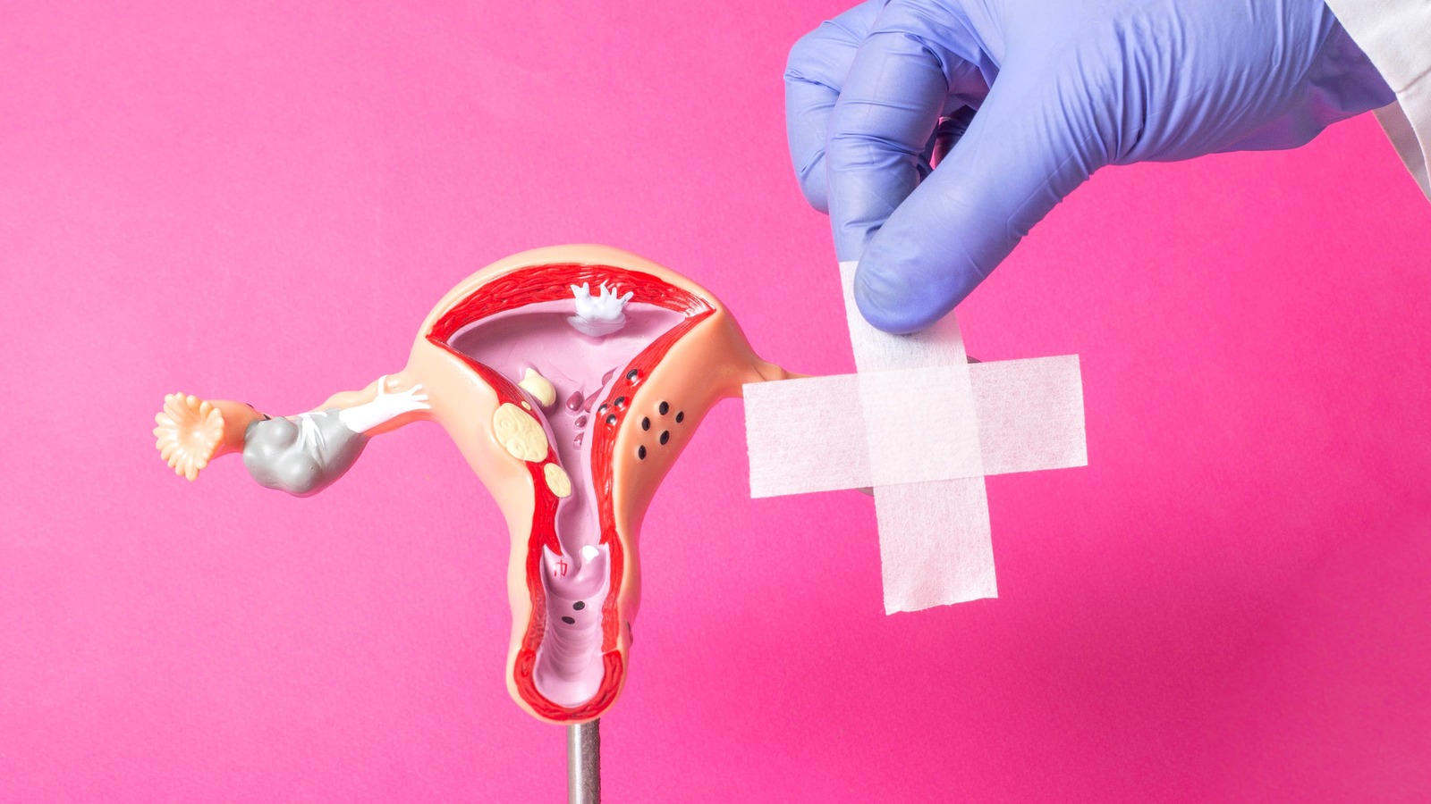 Cervical Stump Cancer: Symptoms, Diagnosis, And Treatment – Health Digest