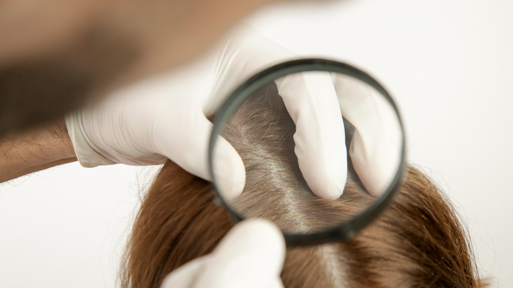 male doctor examining the scalp of a woman 