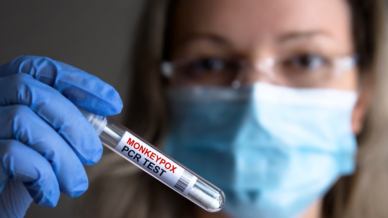Doctor holding monkeypox PCR test