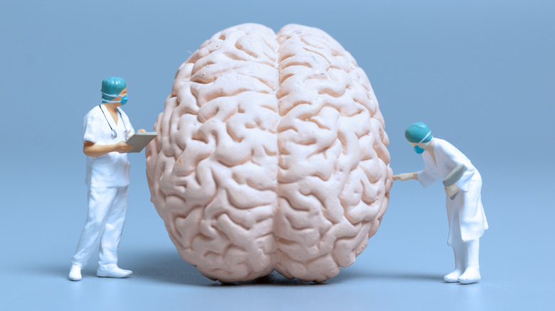 doctor figures studying brain model