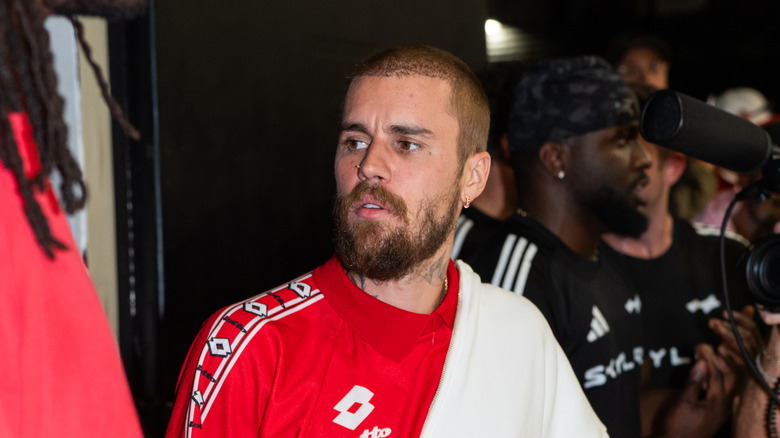 Justin Bieber side view showing patches of hair along hairline on forehead