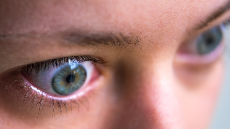 woman with bulging eyes 