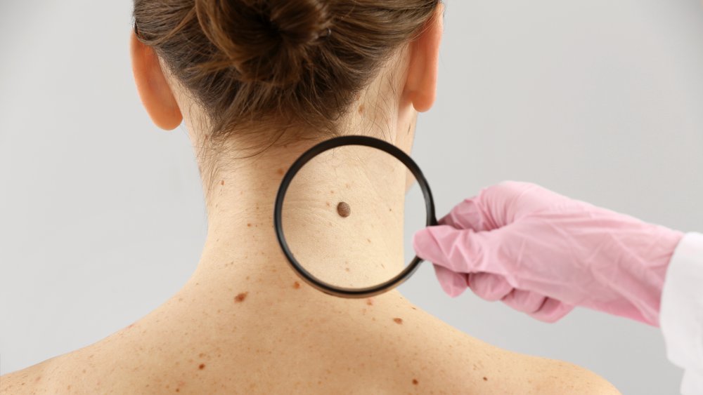 Dermatologist examining moles of patient on light background