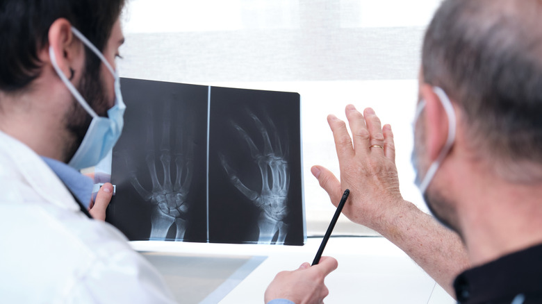 Doctor with arthritis patient's X-ray