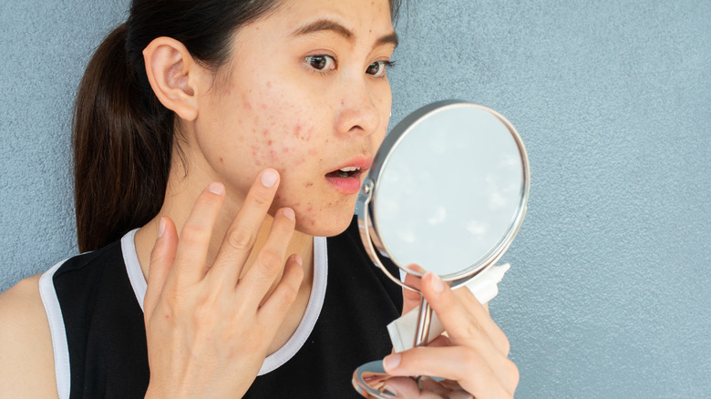 A woman looks at her acne in a mirror
