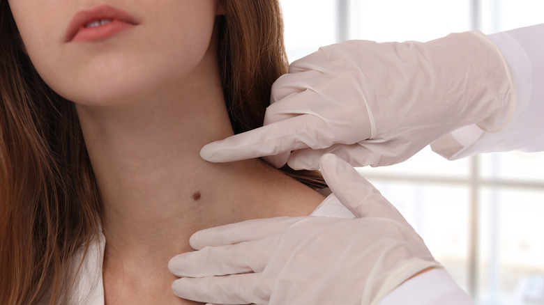 Doctor examining mole on girl's neck
