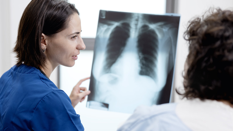 doctor explaining lung x-ray to patient