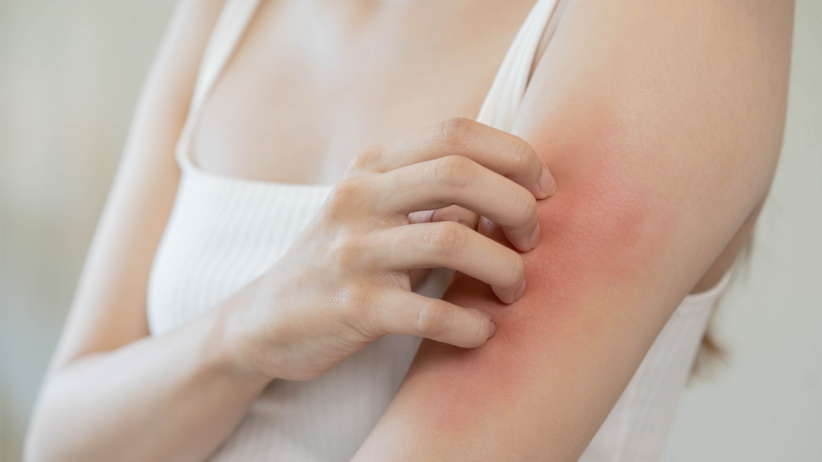 Person scratching a reddened inflamed patch on inner elbow representative of eczema