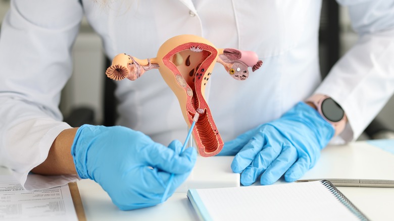 Doctor holds model of uterus