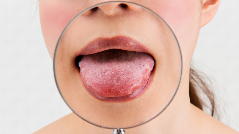 Magnifying glass over woman's tongue