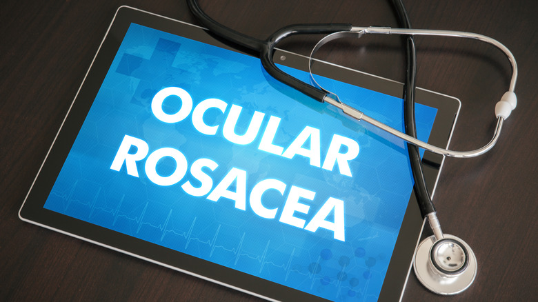 the words 'ocular rosacea'